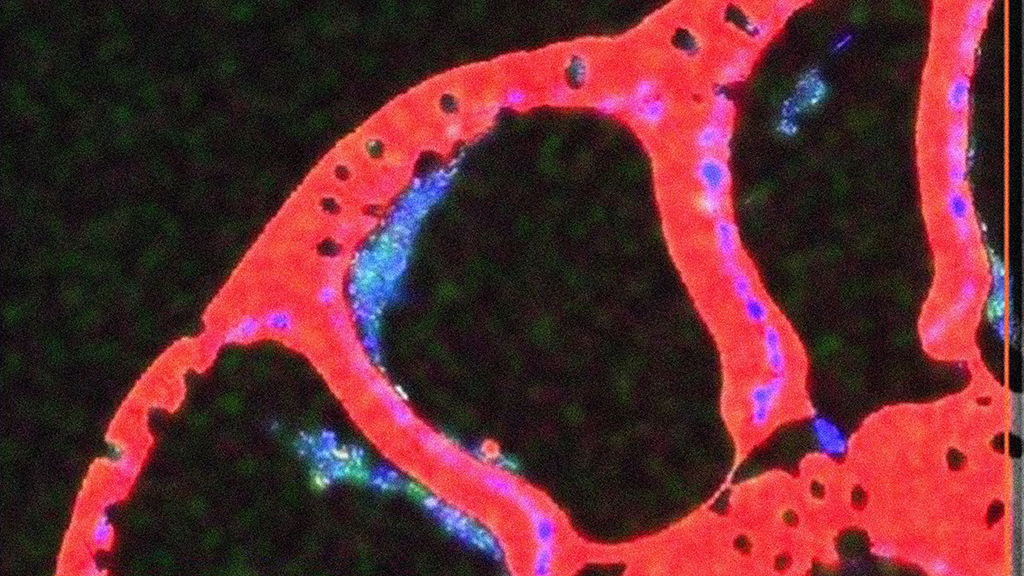 Benthic foram_G.Panieri